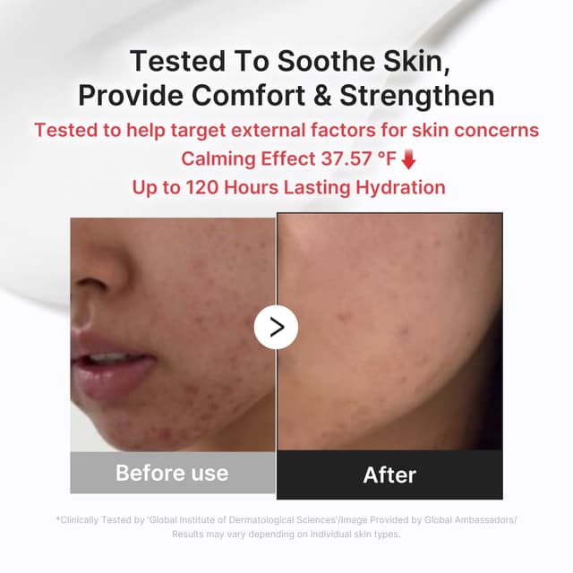 Red Soothing Cream