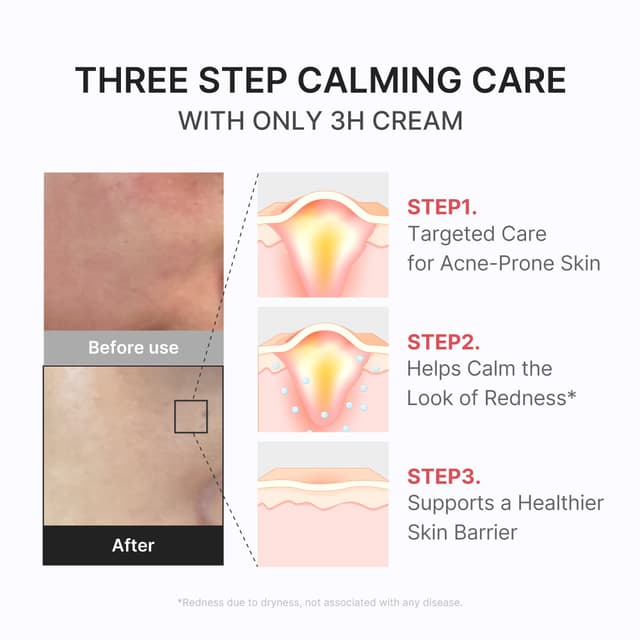Red Soothing Cream