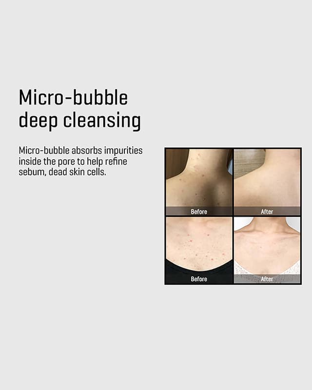 AHA BHA PHA 30 Days Miracle Cleansing Bar